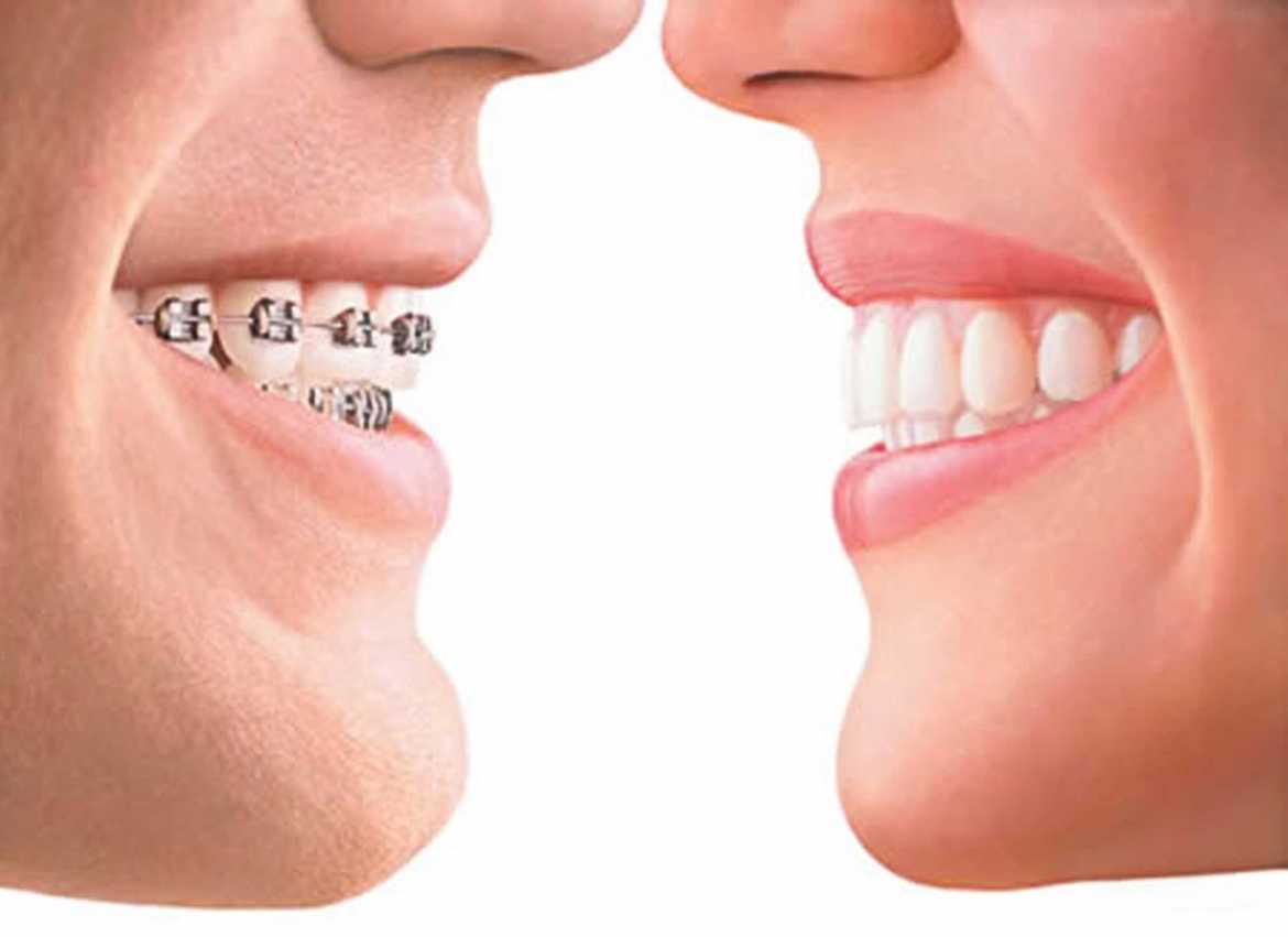 La ortodoncia se practica con diversas finalidades.