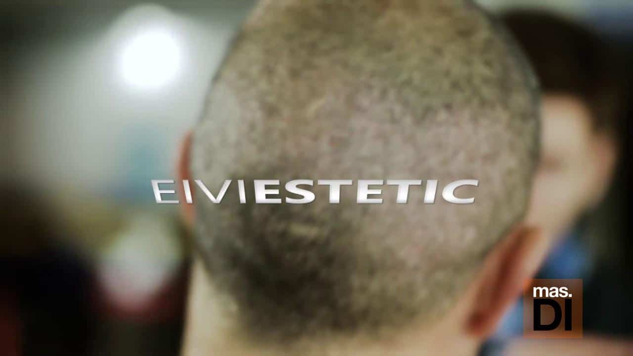 Injerto capilar con todas las garantías y seguridad en Eiviestetic